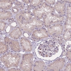 ZBTB24 Antibody, Novus Biologicals 25 &mu;L, Unlabeled:Antibodies, Polyclonal
